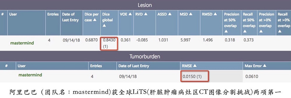 在全球「肝臟腫瘤病灶區CT圖像分割挑戰」（Liver Tumor Segmentation Challenge，LiTS）上，阿里巴巴從近百支科學家隊伍中脫穎而出。